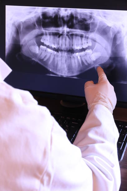 Best Emergency Treatment for Dental Infections or Abscesses in Richfield, MN