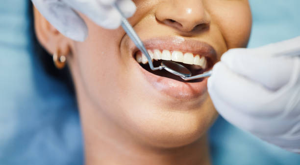 Best Emergency Dental Care for Broken or Chipped Teeth in Richfield, MN